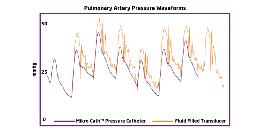 Pulmonary artery pressure waveforms graph with purple and orange lines representing Millar's Mikro-Cath Pressure Catheter versus a Fluid Filled Transducer in mmhg. 