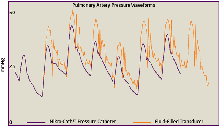 Pulmonary Artery Pressure Measurement PAP Millar