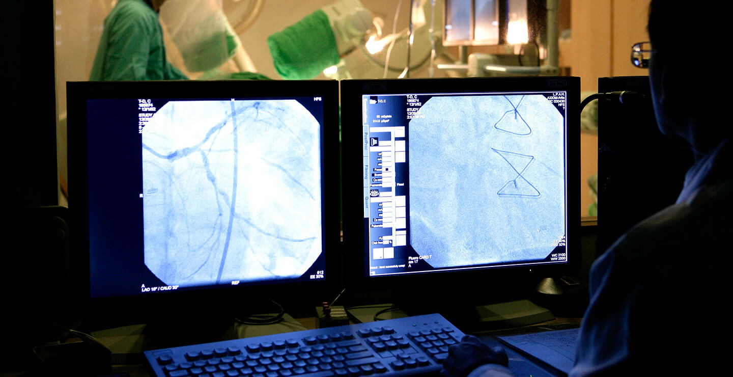 A Millar doctor uses two monitors to study catheters