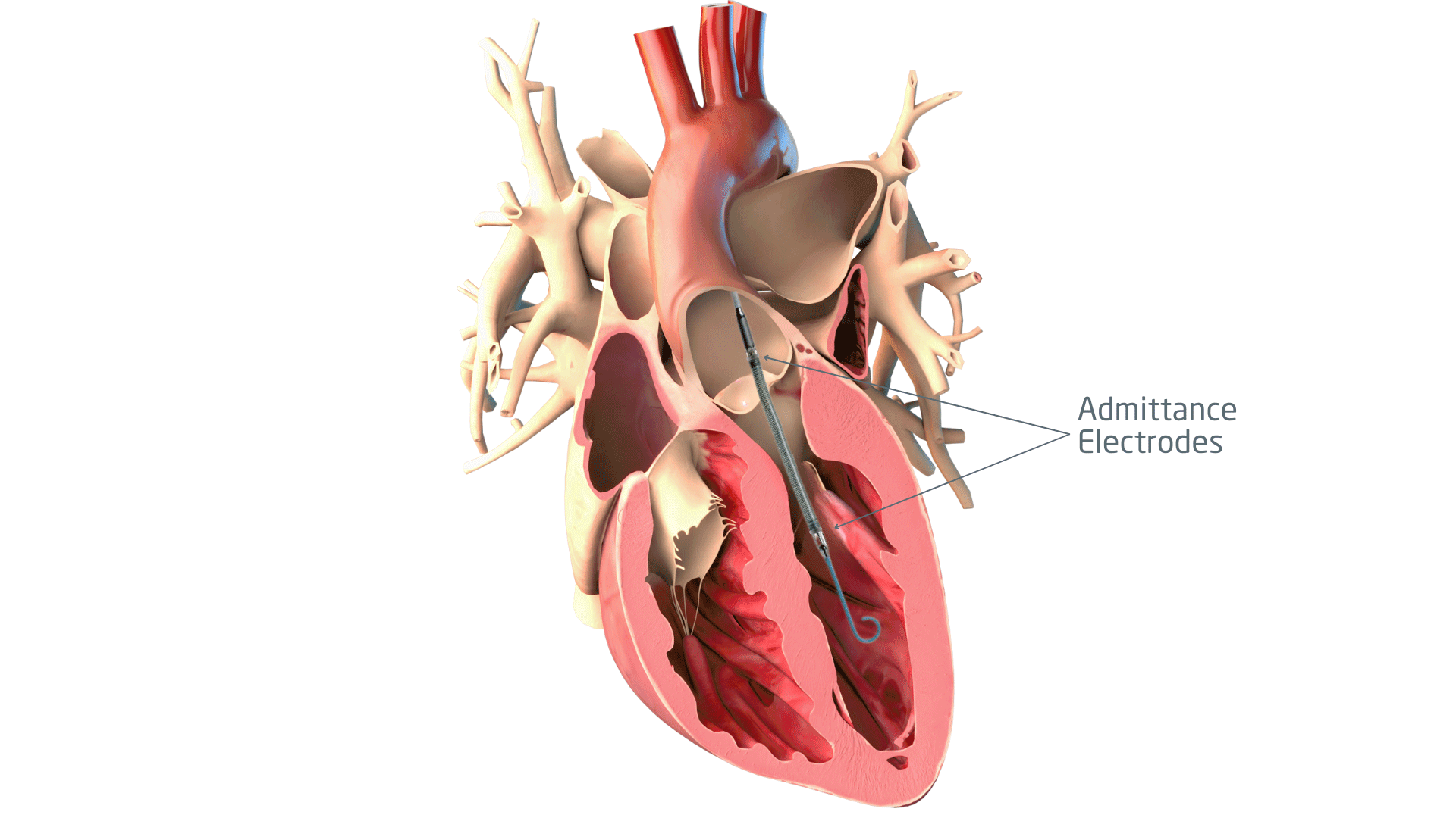 A diagram of the human body highlighting the heart